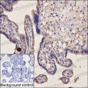 Anti-PGF/PlGF/PLGF Antibody (R3M01)