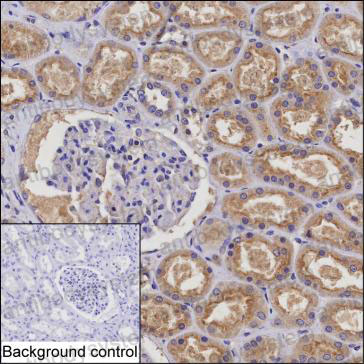 Anti-RARRES1 Antibody (R3M03)