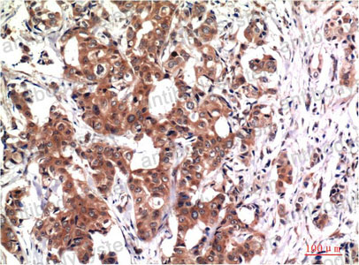Anti-GSK3B Antibody (R3M10)