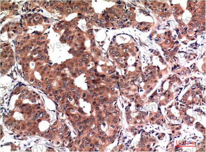 Anti-GSK3B Antibody (R3M11)