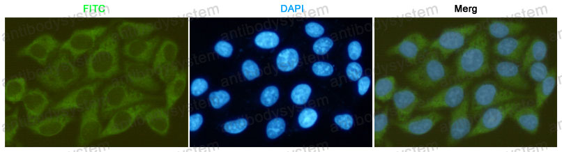 Anti-GSK3B Antibody (R3M12)