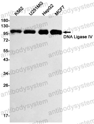 Anti-DNA Ligase IV Antibody (R1X90)