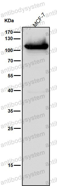 Anti-DNA ligase 4 Antibody (R1X89)