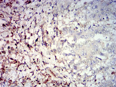 Anti-CD39/ENTPD1 Antibody (R3M20)