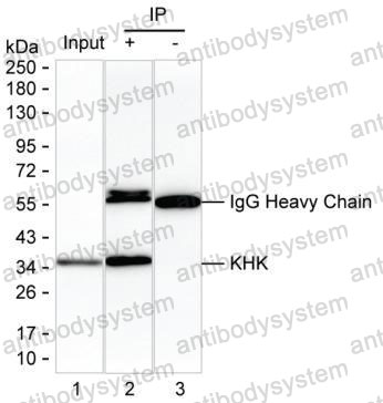 Anti-KHK Antibody (R3M23)