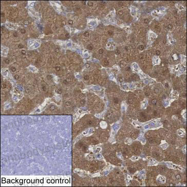 Anti-KHK Antibody (R3M22)