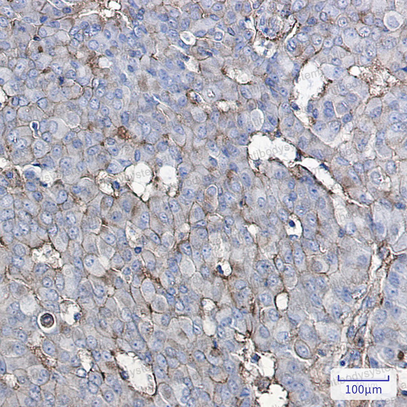 Anti-GNAQ Antibody (R1X97)