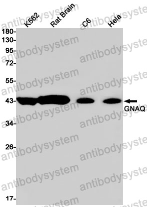 Western blot for Anti-GNAQ Antibody (R1X97) ?>