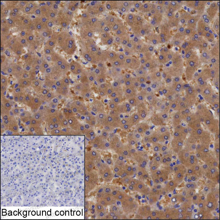Anti-SULT1A1 Antibody (R3M26)