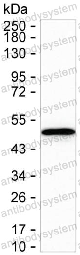 Anti-SERPINB8 Antibody (R3M30)