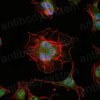 Anti-LHX2 Antibody (R3M31)