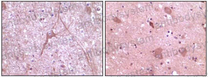 Anti-DNM2 Antibody (R3M34)