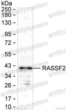 Anti-RASSF2 Antibody (R3M38)