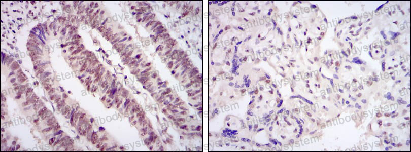 Anti-CDK9 Antibody (R3M39)