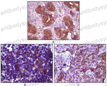 Anti-BLK Antibody (R3M46)