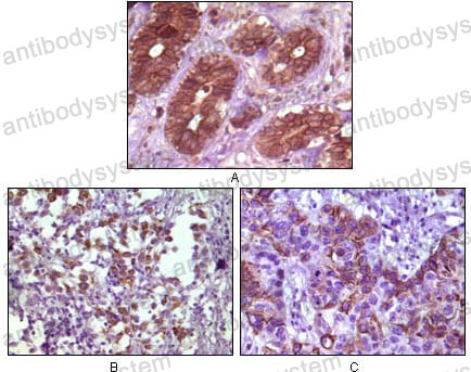 Anti-BLK Antibody (R3M47)