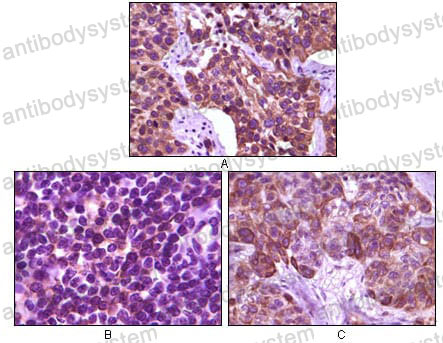 Anti-BLK Antibody (R3M48)
