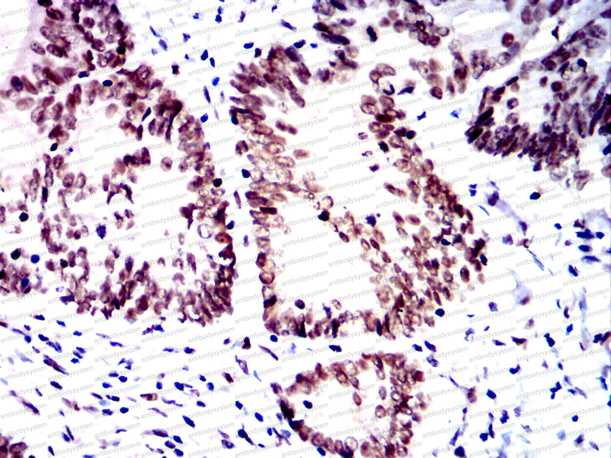 Anti-SMARCA2 Antibody (R3M50)