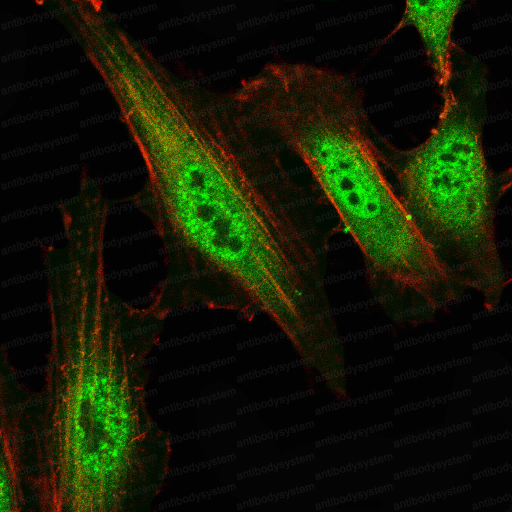 Anti-SMARCA2 Antibody (R3M52)
