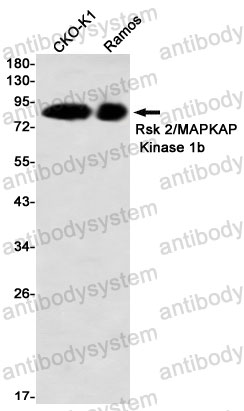 Western blot for Anti-RPS6KA3 Antibody (R1Y40) ?>