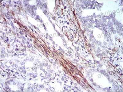 Anti-CNN1 Antibody (R3M72)