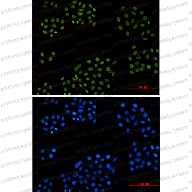 Anti-CCNH Antibody (R1Y48)
