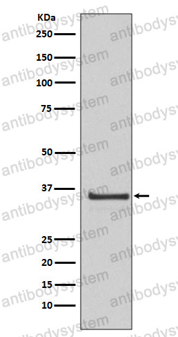 Anti-CCNH Antibody (R1Y46)