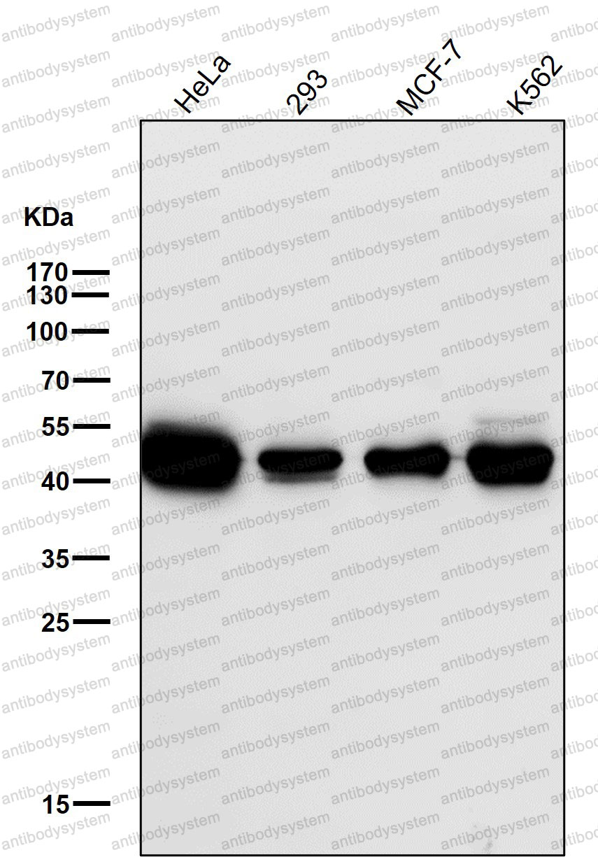 Anti-NEK2 Antibody (R1Y49)