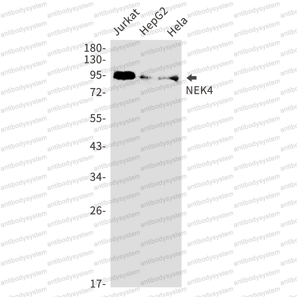 Anti-NEK4 Antibody (R1Y51)
