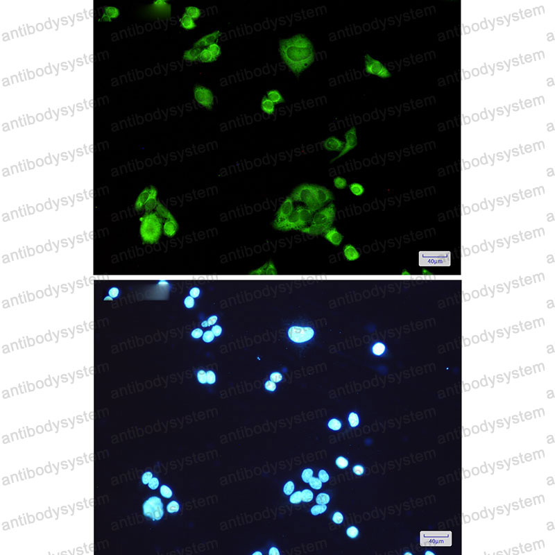 Anti-PGD Antibody (R1Y53)