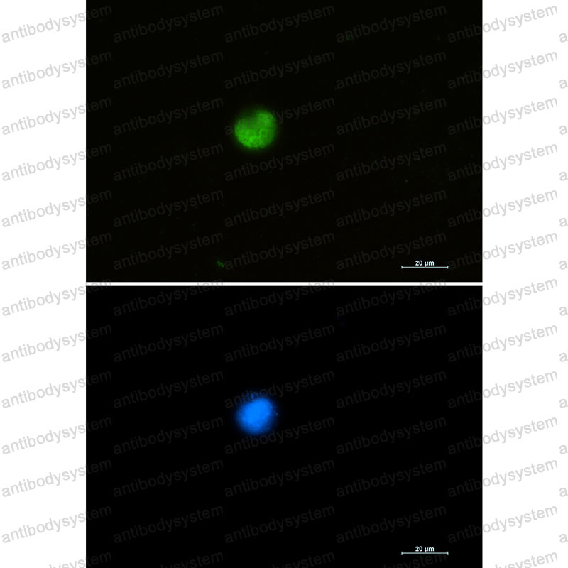 Anti-HNRNPM Antibody (R1Y54)
