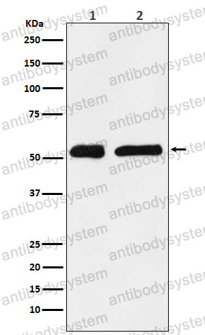 Anti-KPNA2 Antibody (R1Y55)