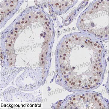 Anti-KPNA1 Antibody (R3M77)