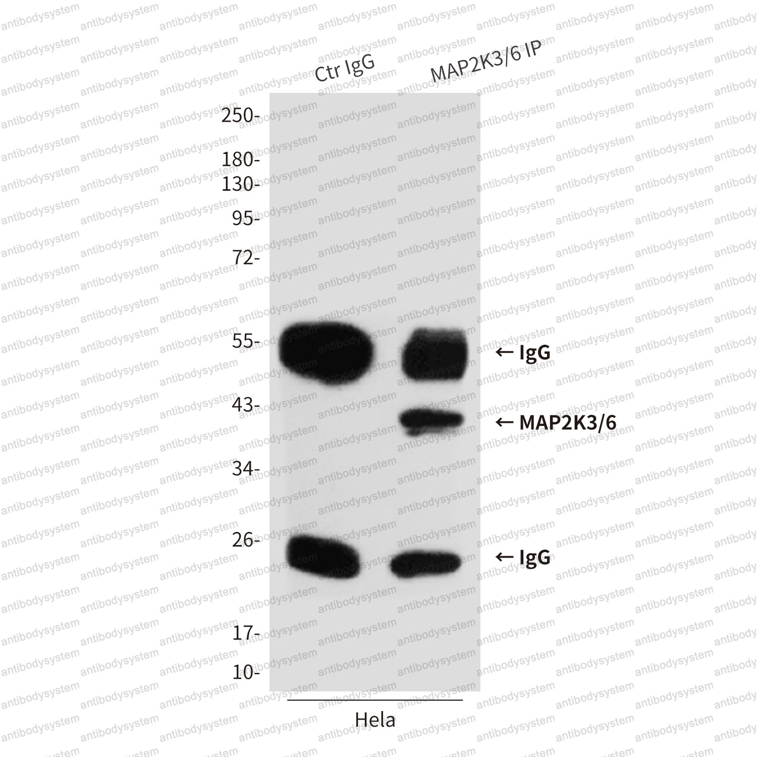 Anti-MAP2K6 Antibody (R3M81)