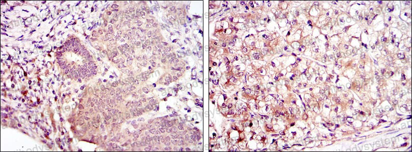Anti-MAP2K6 Antibody (R3M80)