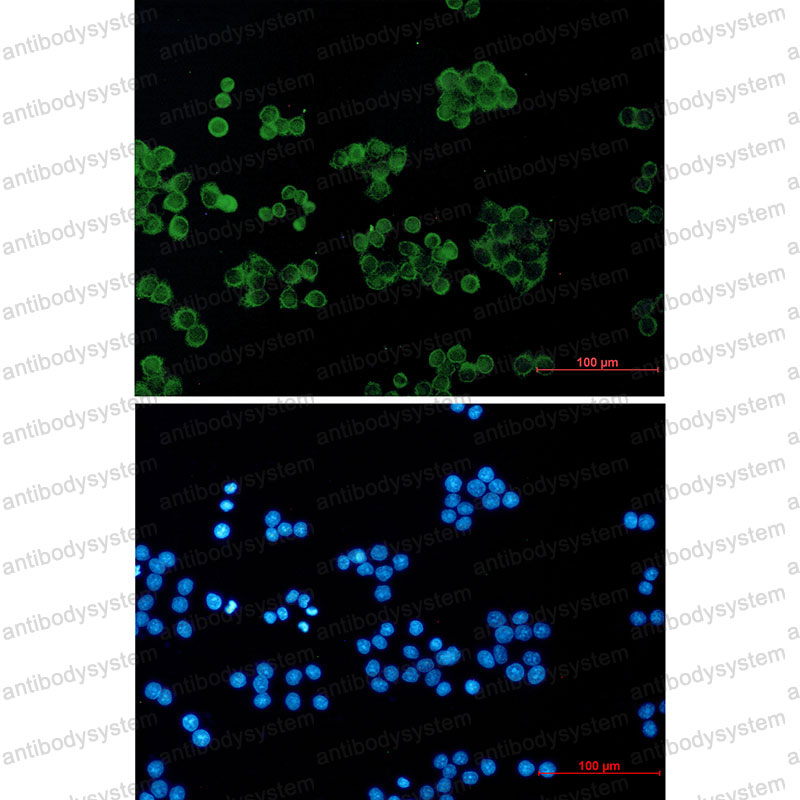 Anti-ARHGDIA Antibody (R1Y57)