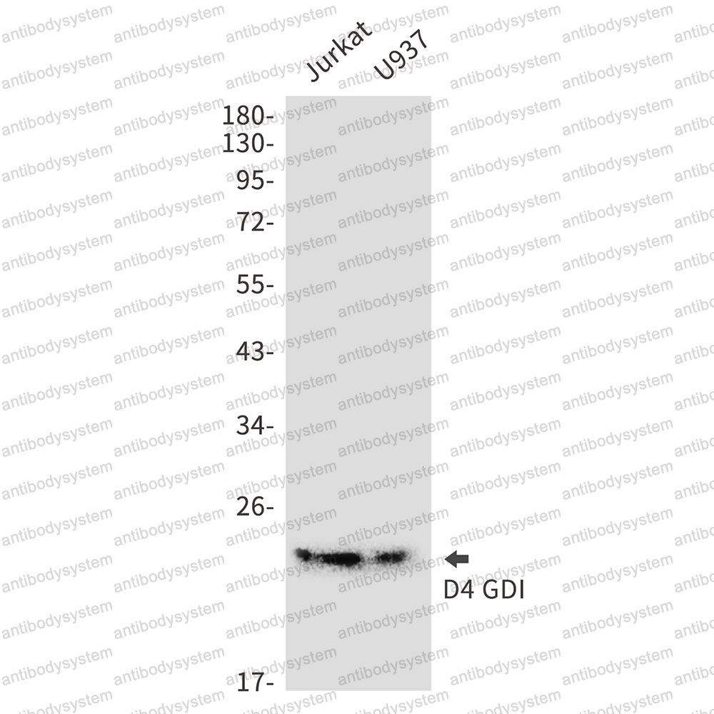 Anti-ARHGDIB Antibody (R1Y58)