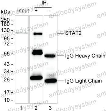 Anti-STAT2 Antibody (R3M83)