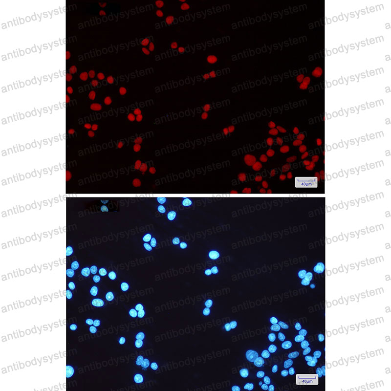 Anti-MSH6 Antibody (R1Y61)