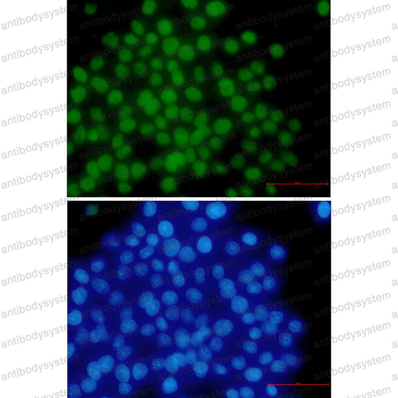 Anti-MSH6 Antibody (R1Y62)