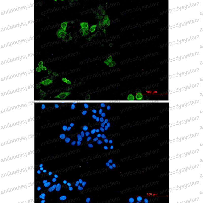 Anti-KIF11 Antibody (R1Y64)