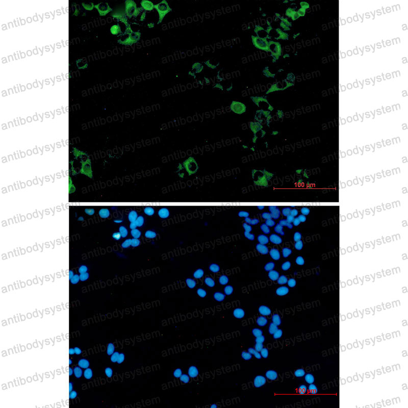 Anti-KIF11 Antibody (R1Y63)