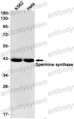 Anti-SMS Antibody (R1Y67)