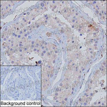 Anti-SMS Antibody (R3M92)