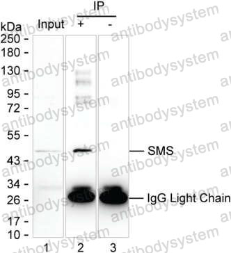 Anti-SMS Antibody (R3M93)