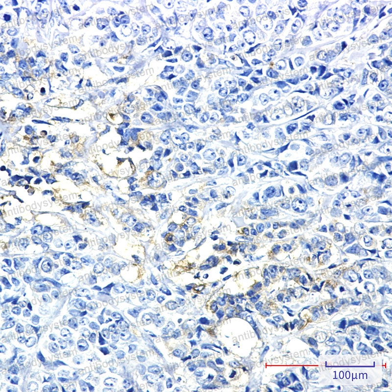 Anti-HK2 Antibody (R1Y68)