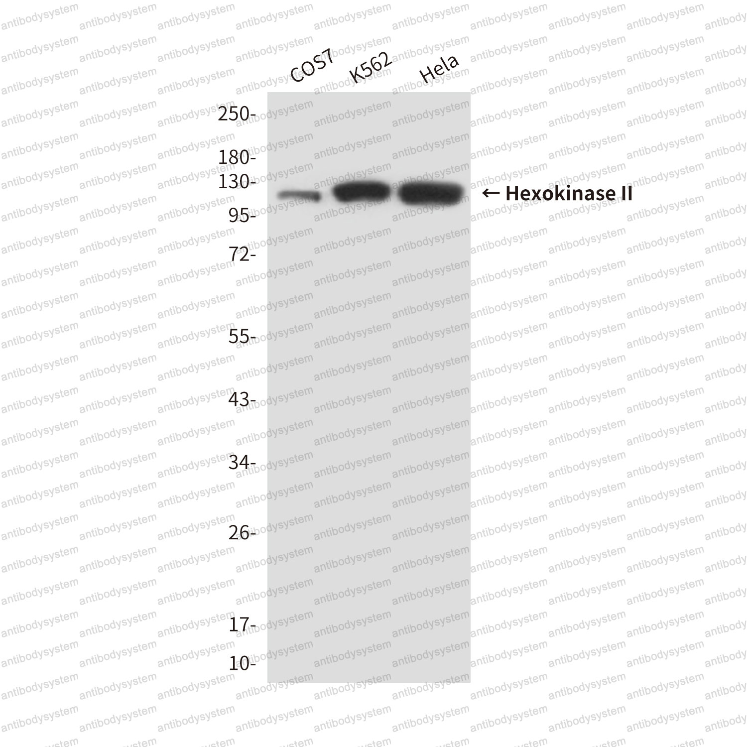 Anti-HK2 Antibody (R3M95)