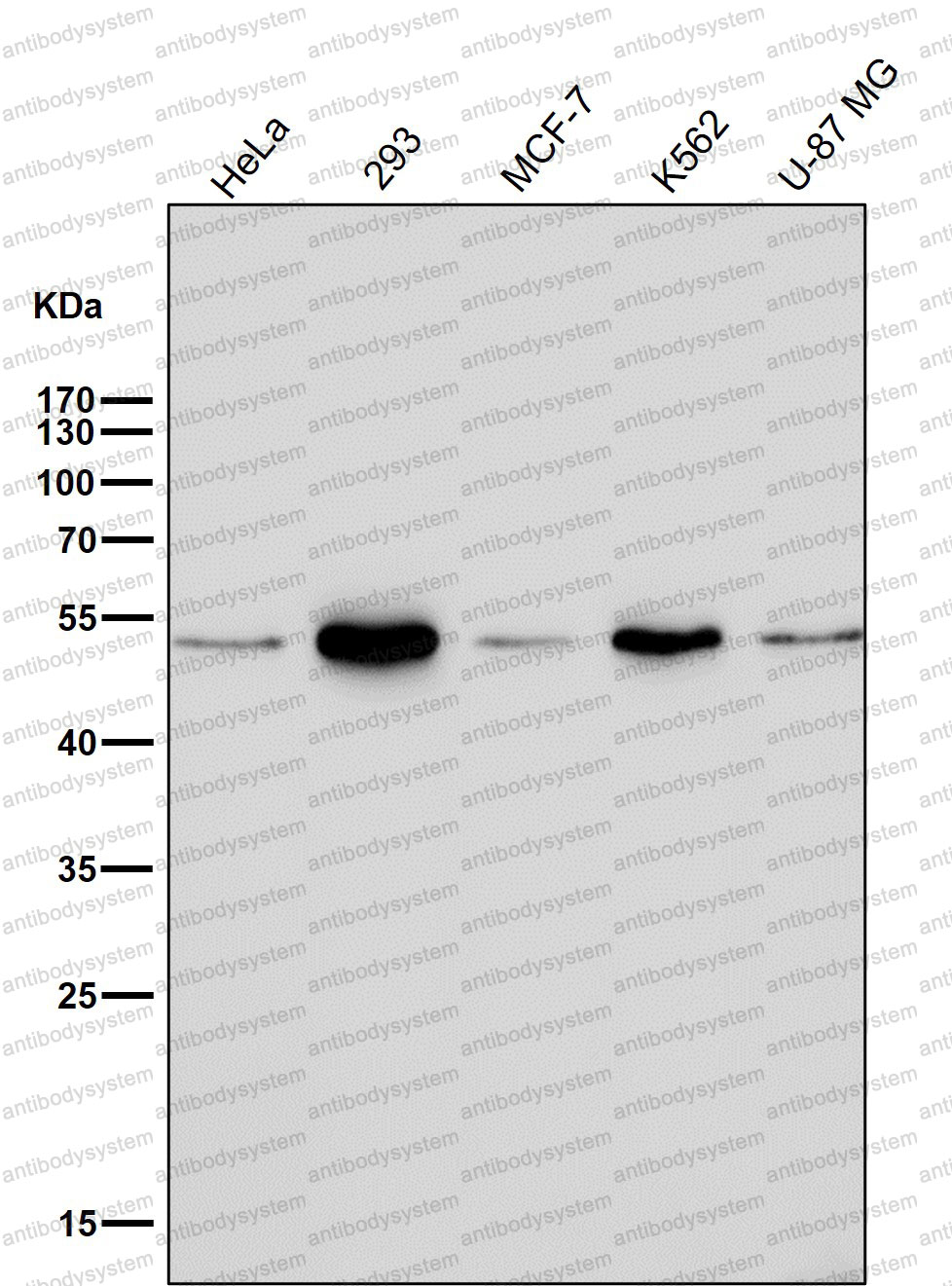 Anti-EFNB2 Antibody (R1Y69)