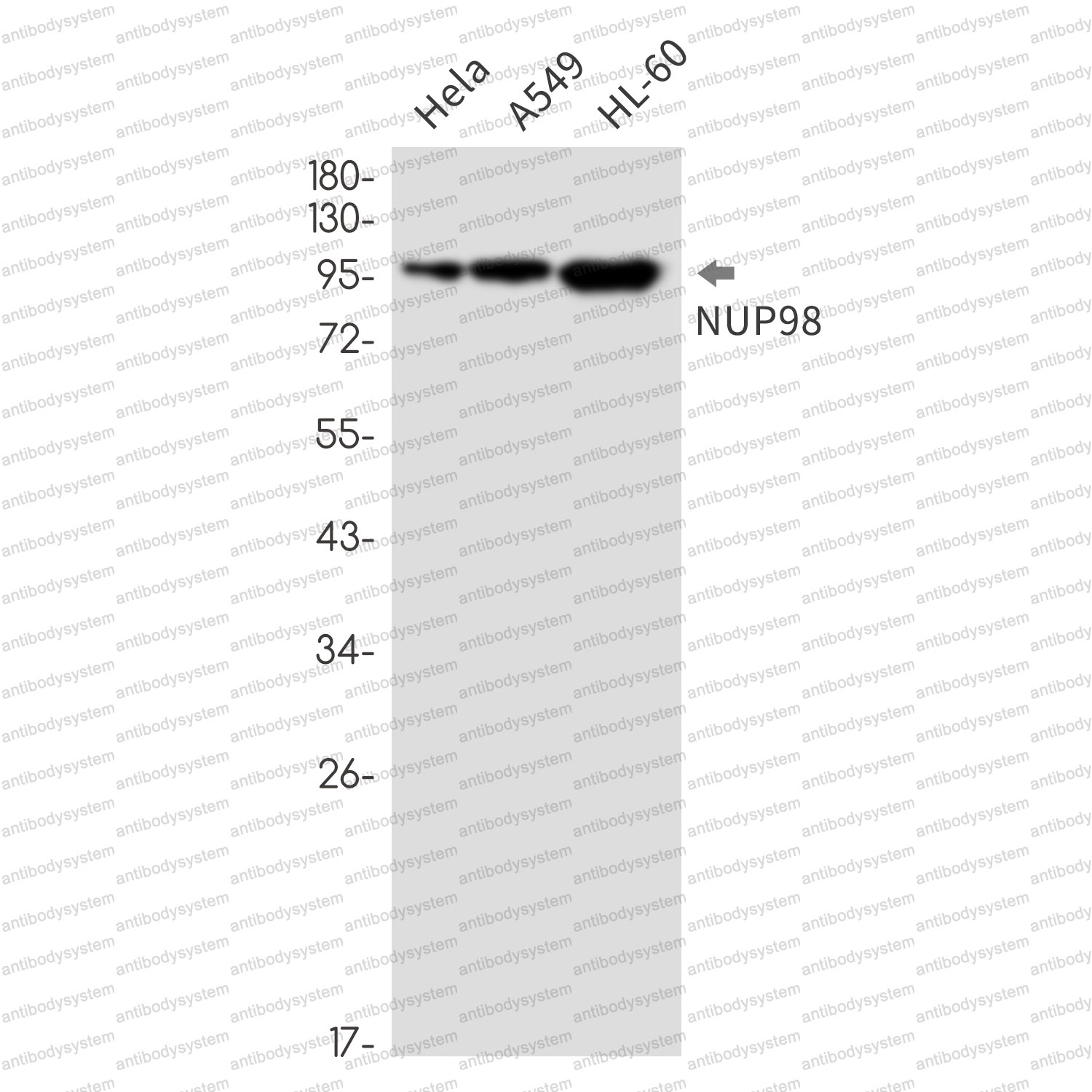 Anti-NUP98 Antibody (R1Y71)