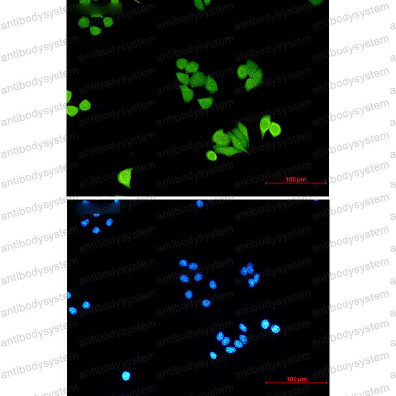 Anti-PLK1 Antibody (R1Y72)
